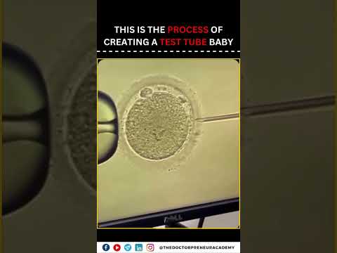IVF: A Journey to Parenthood Through Advanced Fertility Solutions