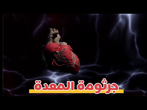 علاقة جرثومة المعدة بالقلب