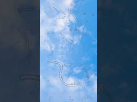 Откуда берутся мушки перед глазами 👀