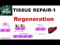 Tissue Repair and Regeneration Concepts