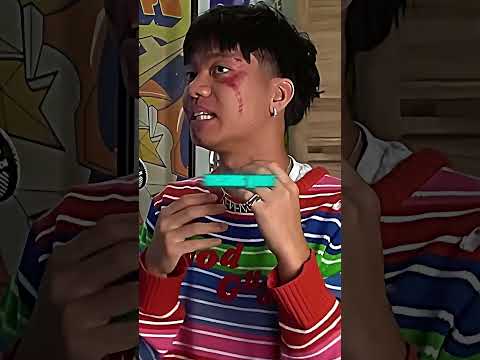 Spiritual Meaning Of Breaking A Bone