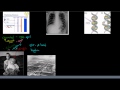 Mutagenic Effects of Radiation