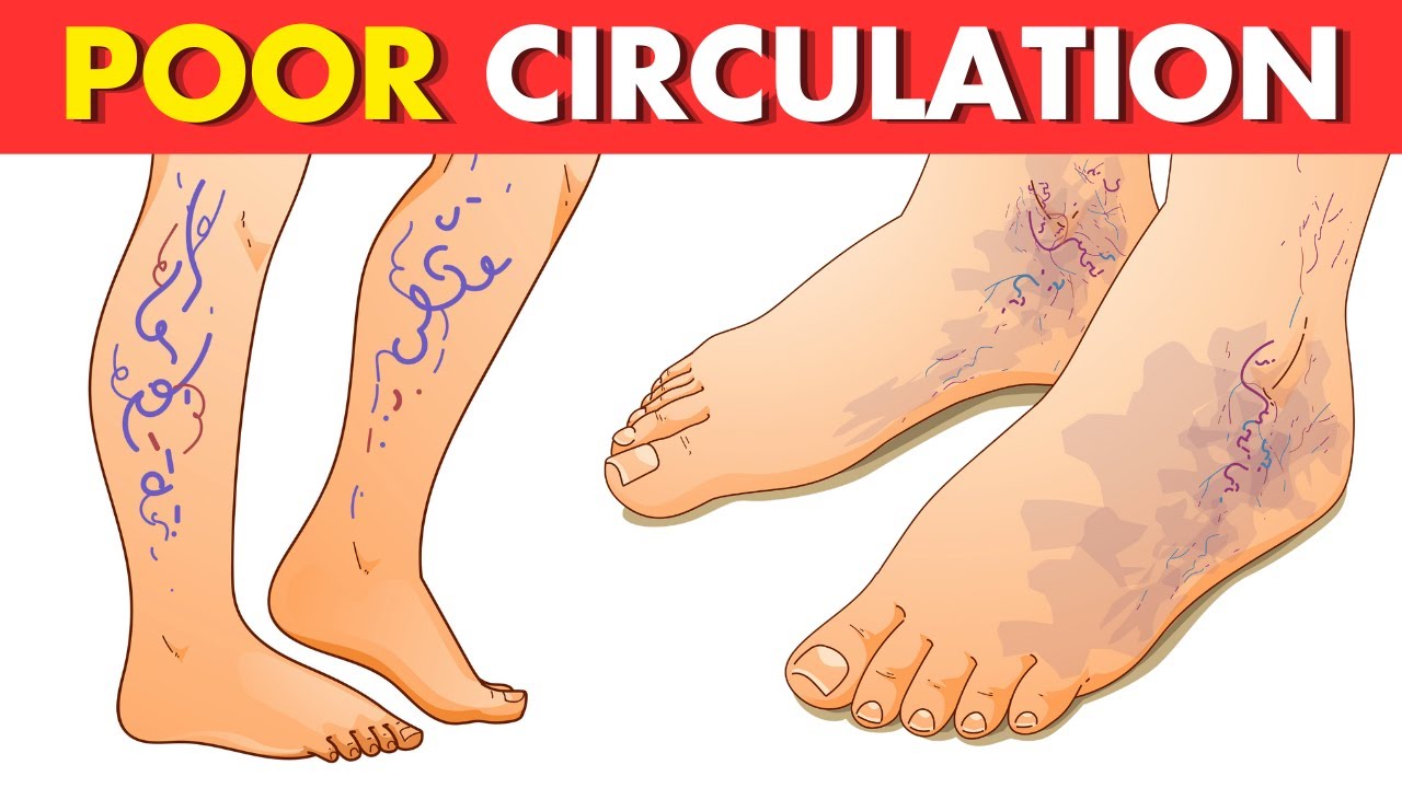 5 Warning Signs of Poor Circulation and How to Fix It