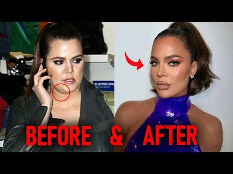 Why The Kardashians LIED for Years About Plastic Surgery (And Why They're Coming Clean)