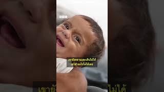 ชีวิตทุกข์ยากของแม่และเด็กในกาซา ไร้น้ำนมเลี้ยงลูกจากวิกฤตขาดแคลนอาหาร - BBC News ไทย #bbcthai #news