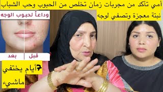بنبتة طبيعية غتهناي لأبد من الحبوب وحب الشباب وكتصفي البشرة أمي تأكد عليها معجزة 