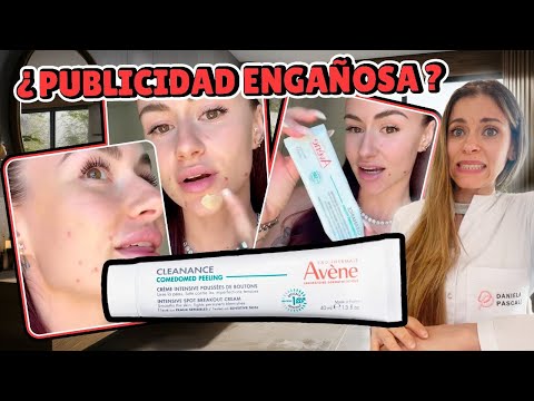 ¡NO COMPRES NADA PARA EL ACNÉ ANTES DE VER ESTO!