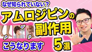アムロジピンの副作用５選【高血圧の薬】