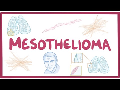 Mesothelioma - causes, symptoms, diagnosis, treatment, pathology