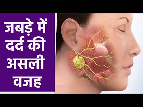 जबड़े में दर्द क्यों होता है | जबड़े में दर्द का कारण | Jabade Me Dard Kyu Hota Hai | Boldsky