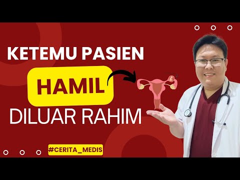 #CERITA_MEDIS (episode 1) KETEMU PASIEN HAMIL DILUAR RAHIM