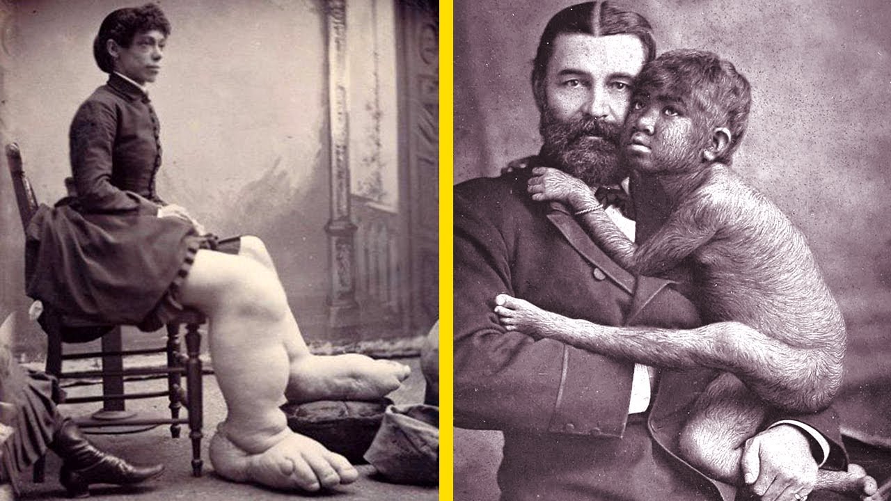 A Brief Dark History Of Freak Shows - A Day In History