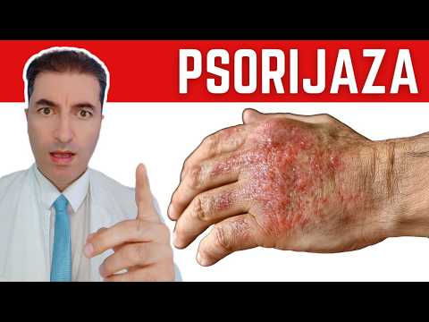 Psoriasis GONE in No Time with THIS Miracle Oil!