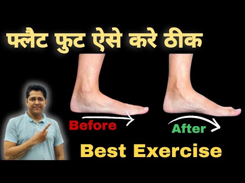 Best Exercise For Flat feet in hindi. फ्लैट फुट कैसे ठीक करे। flat foot correction Exercise at home.