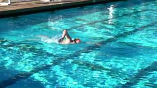 Exaggerated head position