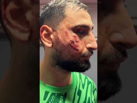 Cenas Fortes: Donnarumma, do PSG, leva pisão na cara e fica com marcas; veja a imagem impressionante