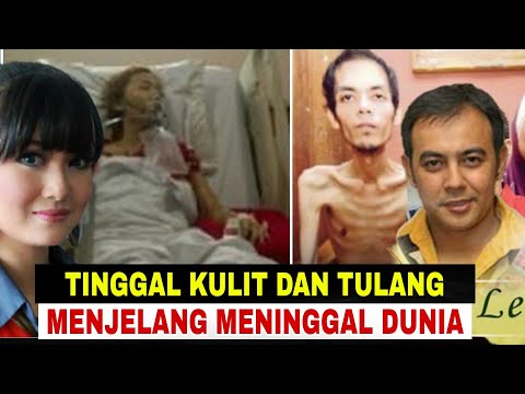 Memprihatinkan‼️Tubuh 11 Artis ini Nyaris Tinggal Kulit Pembalut Tulang Menjelang Meninggal Dunia