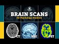 Brain Scanning Technologies Overview