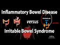 Understanding IBD and IBS