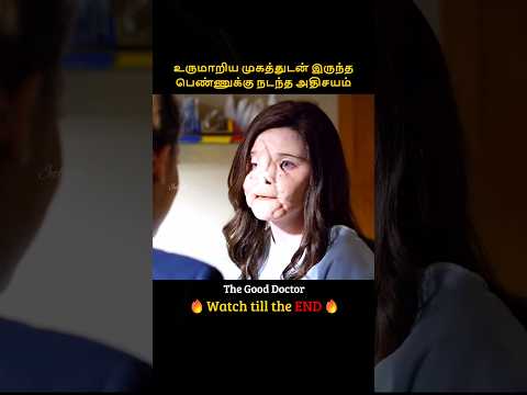 Girl had a bad life due to this face | உருமாறிய முகத்துடன் இருந்த பெண்ணுக்கு நடந்த அதிசயம் | Infogle