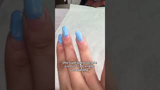 Olha a situação da minha unha