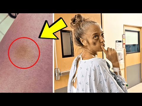 Girl Notice Yellow Tint to Her Skin. Doctors Tell Her The Shocking Truth, Every Girl Must Be Careful