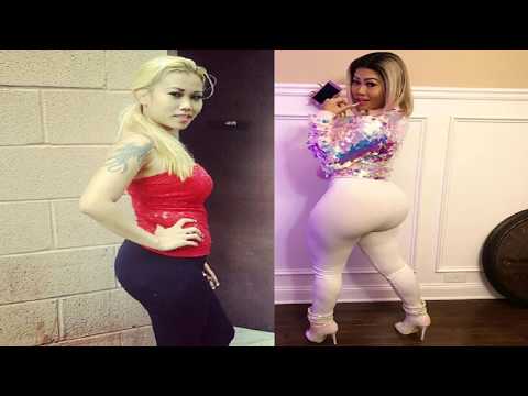 Lovely Mimi Before After Plastic Surgery! Hot Rapper Was