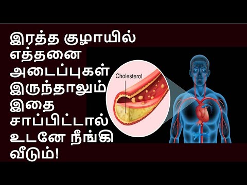 இதை சாப்பிட்டால் இதயத்தில் அடைப்பே இருக்காது | Remedy for Blood vessel blackage,