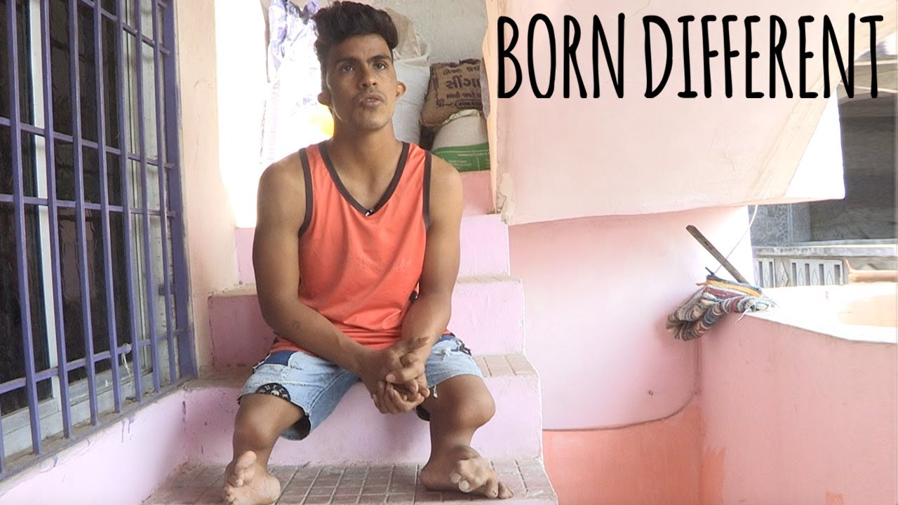 I'm missing my lower legs - and no one knows why - born different