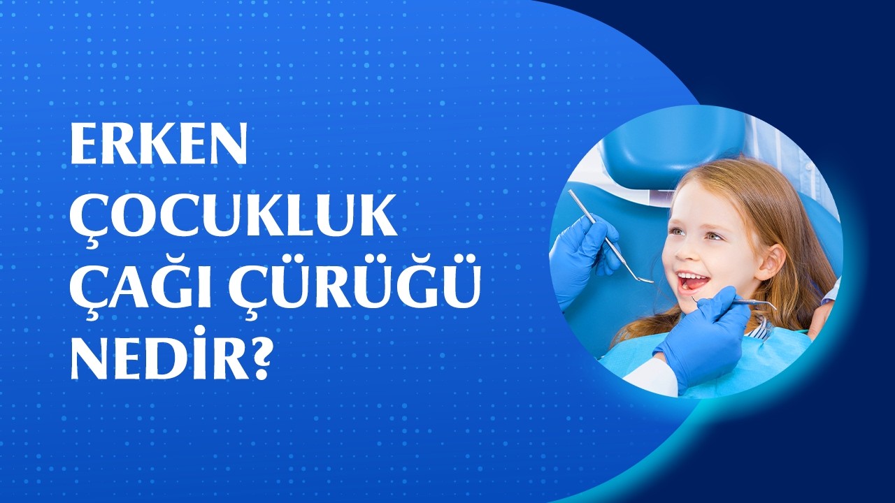 Erken Çocukluk Çağı Çürükleri Nasıl Başlar? Nelere Dikkat Edilmelidir?