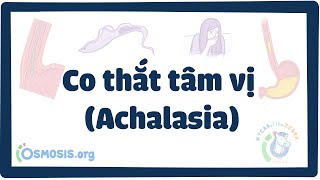 Co thắt tâm vị (Achalasia)