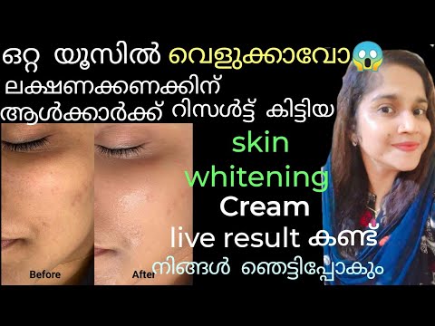 😱ലക്ഷണക്കണക്കിന് ആൾക്കാർക്ക് റിസൾട്ട് കിട്ടിയ Skin whitening cream| live result#skinwhitening