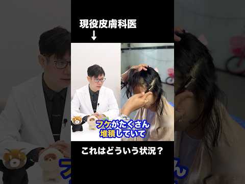 先生！この頭皮、どういう状況！？ #shorts