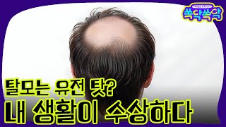 [쏙닥쏙닥] 탈모는 유전 탓? 내 생활이 수상하다