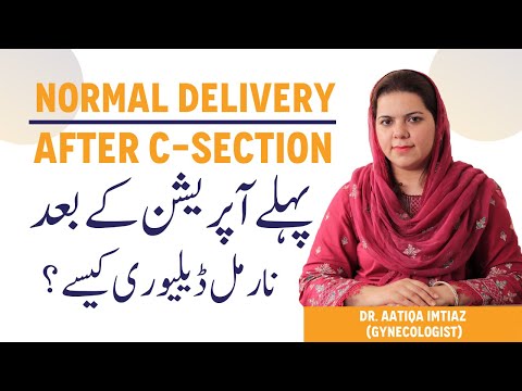 Is Normal Delivery Possible After C Section? - Kya Cesarean Ke Baad Normal Delivery Ho Sakti Hai