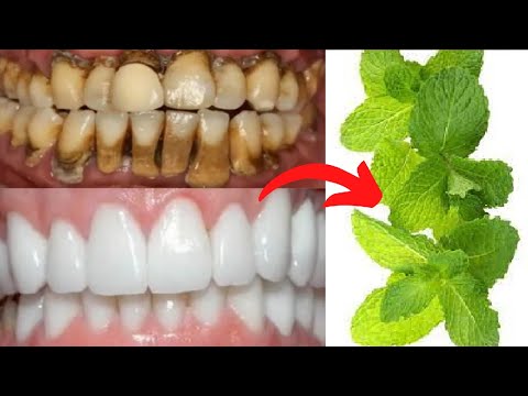 Teeth whitening in two minutes removes yellowing and tartar falls after rubbing your teeth