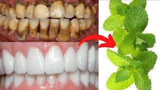 Teeth whitening in two minutes removes yellowing and tartar falls after rubbing your teeth