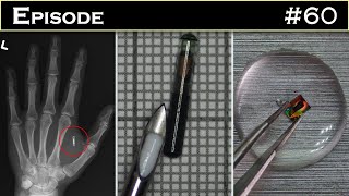Bio implant sous-cutanée, quand la fiction devient réalité