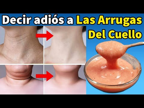 En 7 Días, Obtenga Una Piel Del Cuello Más Suave Con Esta Mezcla - Solo 3 Ingredientes