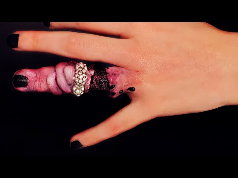 PIEL DESGARRADA Y AMORATADA AL QUITAR ANILLO - Makeup FX