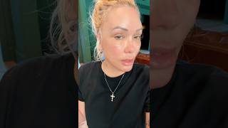 Day 10 after facelift