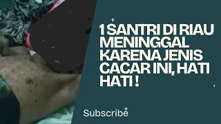 Jenis Cacar Ini Penyebab Santri di Riau Meninggal Dunia, Ketahui Gejalanya #penyakit #cacar