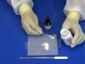 Zinc Oxide Eugenol Cement Applications