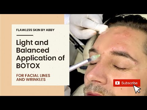 Botox application for facial lines and wrinkles.