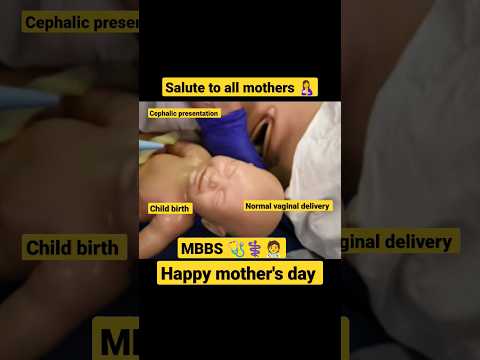 Vaginal delivery|| #shorts #mom #mothersday #mbbs #neet #health #healthtips #women ||Secret Medico