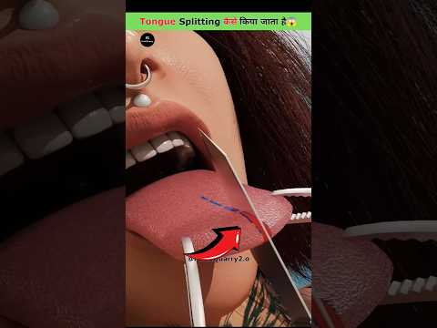 How Tongue Splitting Is Done