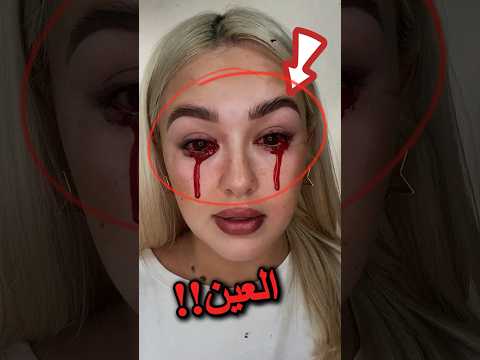 ما الذي يحدث لعين هذة الفتاة! 😱👀