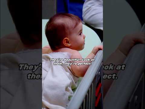 Conjoined twins have three kidneys when they are together, but only two after they are separated!