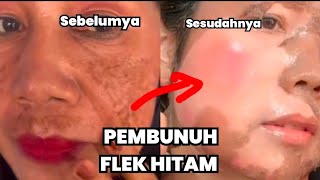 RIBUAN ORANG BERHASIL!! RACIKAN SENDIRI, HANCURKAN SEMUA JENIS FLEK MENAHUN DALAM HITUNAGN MENIT