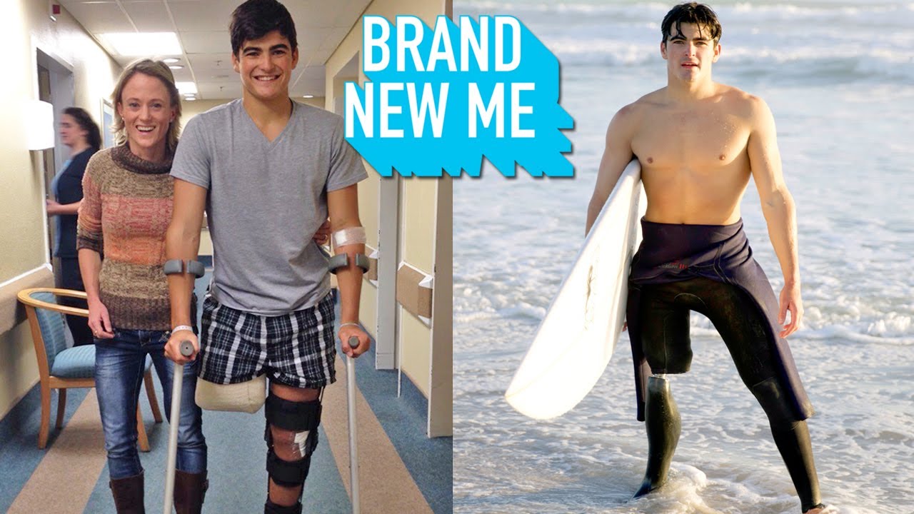 A shark bit my leg off - so i took up surfing - brand new me
